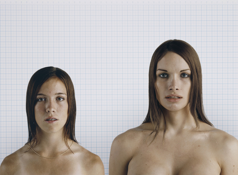 Teen and Transgender Comparative Study No. 2, 2008