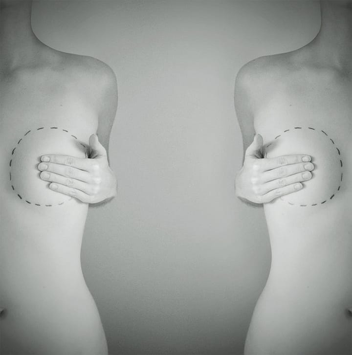 Replacing Things Lost